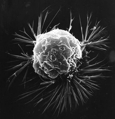 Cancer cell