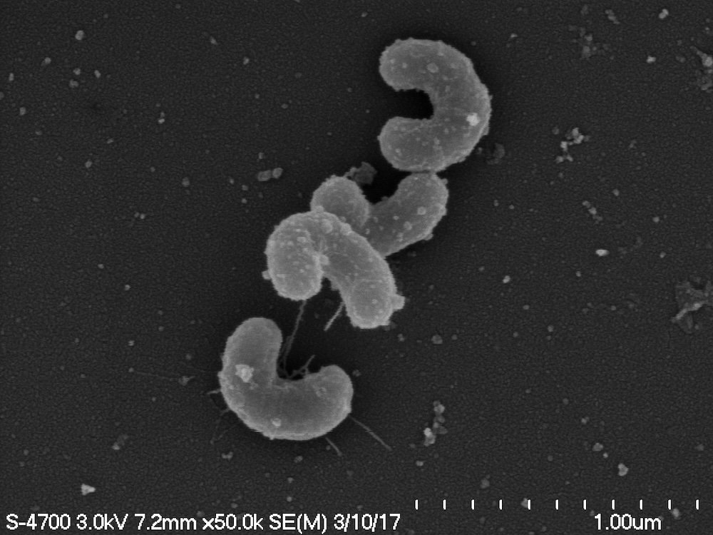 Black and white picture of macaroni-shaped actinobacteria.